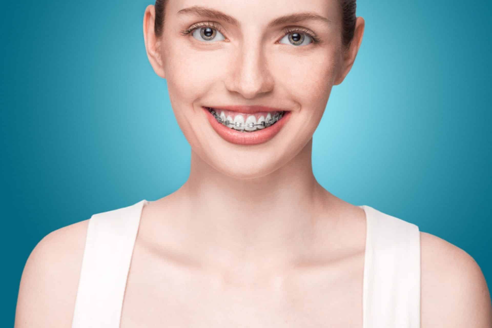 Can Braces Close Tooth Gaps for Good? Honey Orthodontics in Gurnee IL